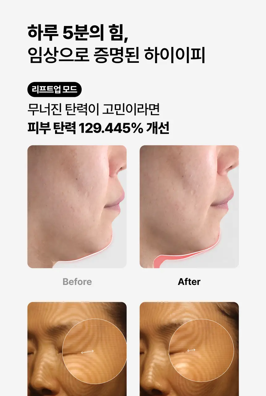 [홈케어/5분순삭,탄력흡수 더블케어] 듀얼소닉 하이이피 더블샷 (+비건콜라겐젤 정품 증정) 상세페이지 3